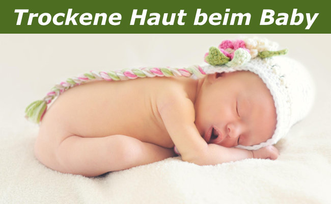 Trockene Haut beim Baby - Was Eltern tun sollten und was nicht